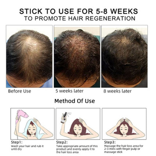 Advanced Hair Growth Serum - Fa'Ra Way