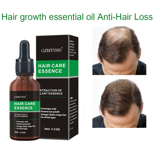 Advanced Hair Growth Serum - Fa'Ra Way