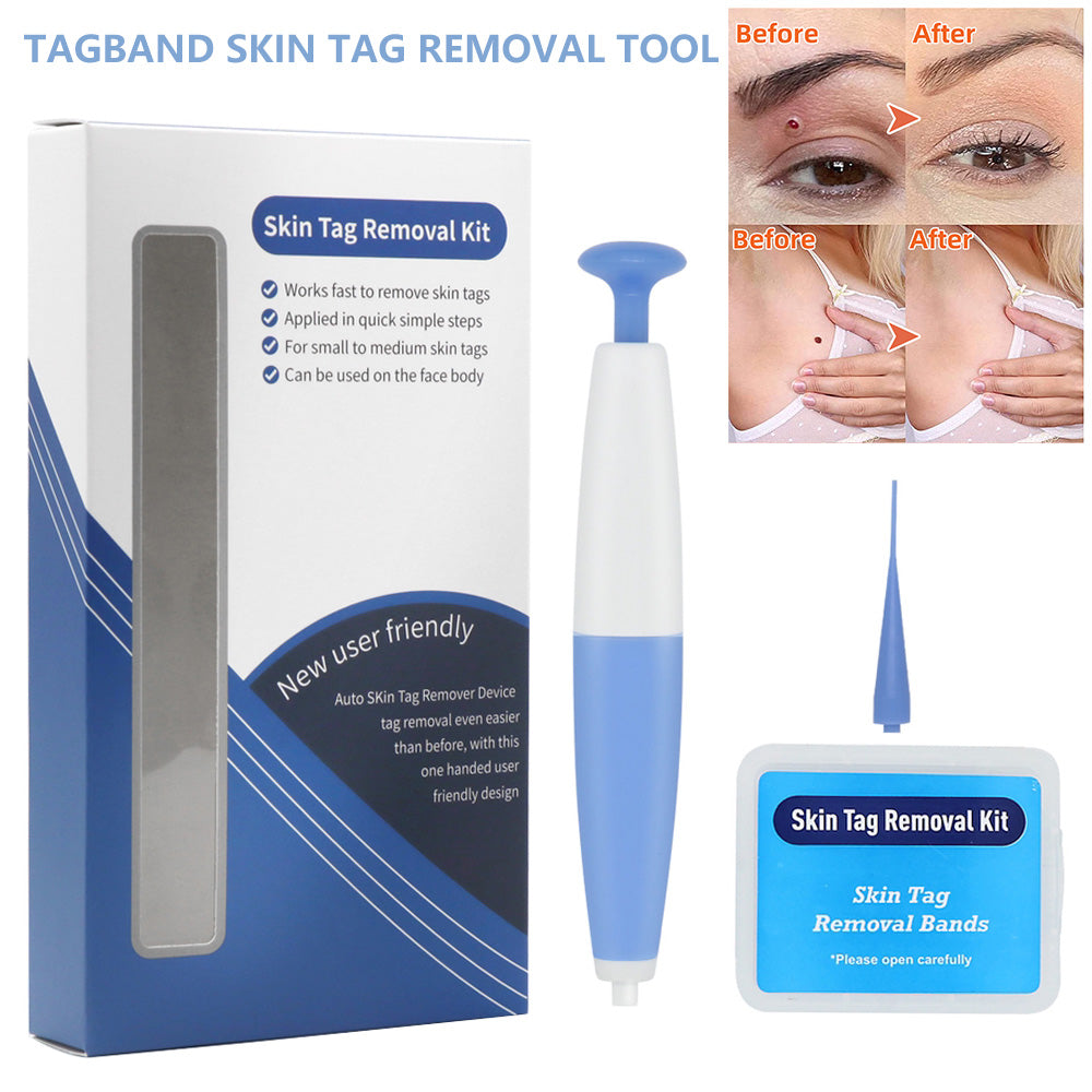 Skin Tag Removal Kit Home Use Mole Wart Remover Micro Band Skin Tag Treatment Tool Easy To Clean Skin Care Tool - Fa'Ra Way
