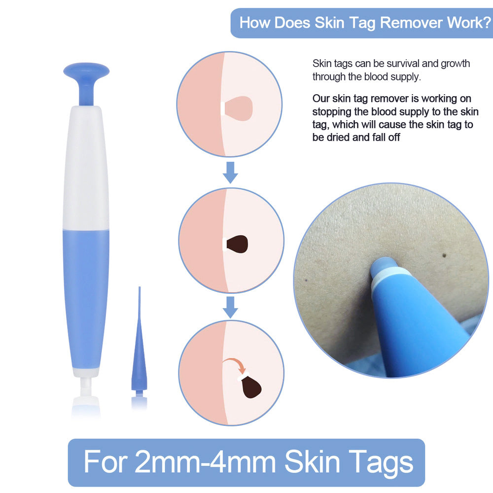 Skin Tag Removal Kit Home Use Mole Wart Remover Micro Band Skin Tag Treatment Tool Easy To Clean Skin Care Tool - Fa'Ra Way