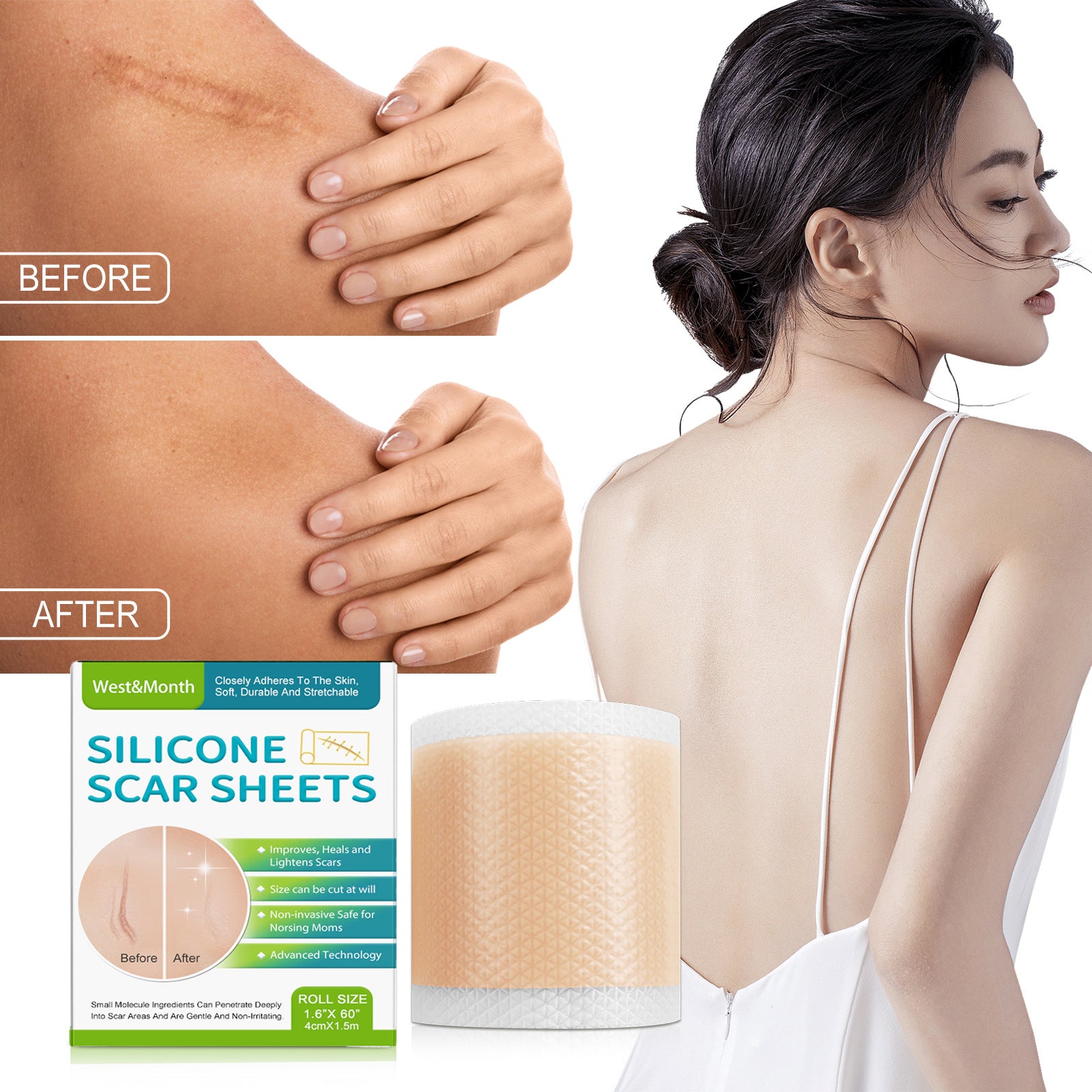 Silicone Scar Repair Stickers - Fa'Ra Way