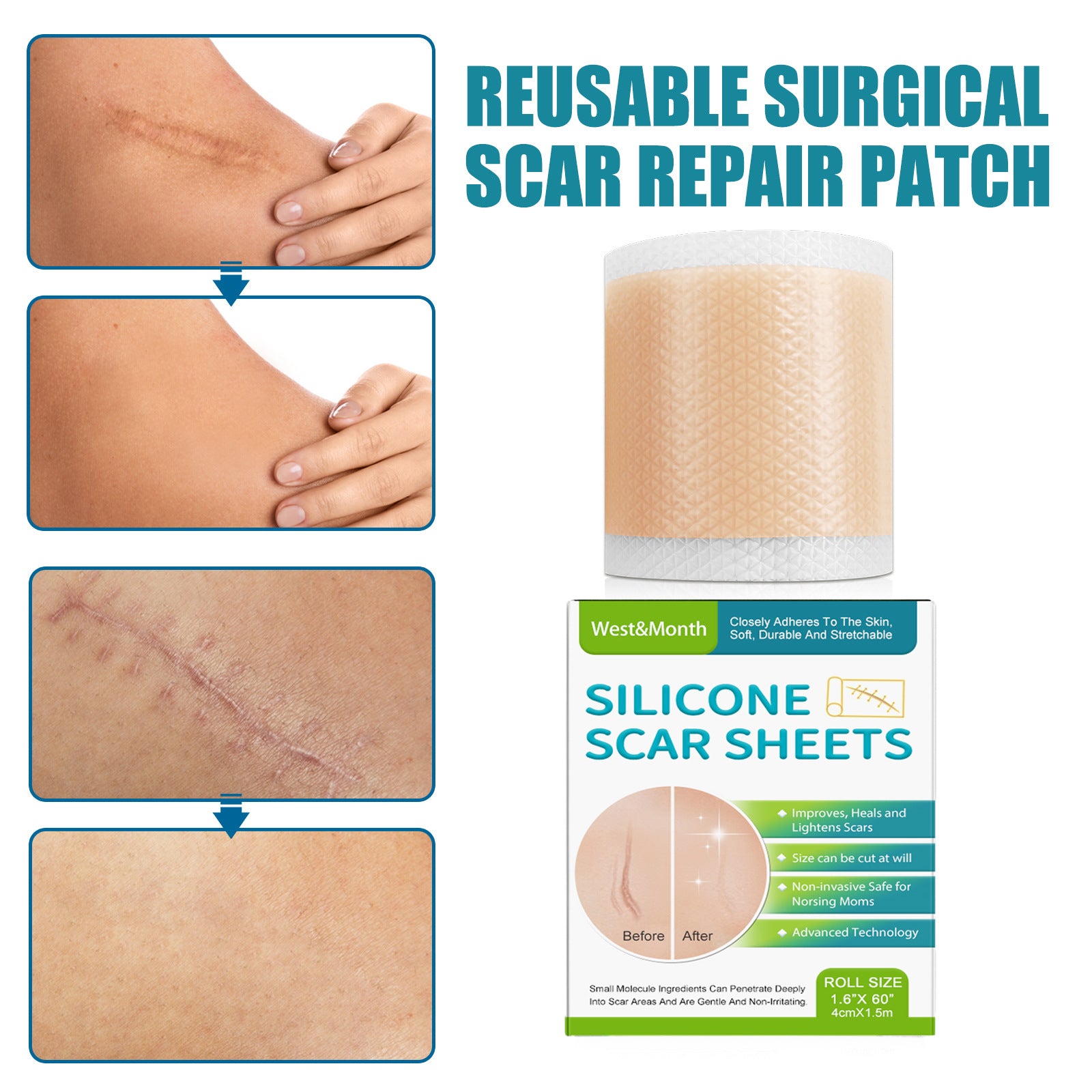 Silicone Scar Repair Stickers - Fa'Ra Way
